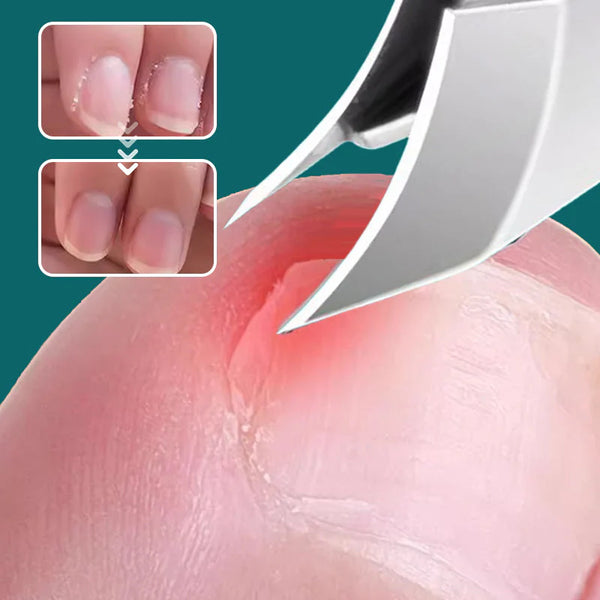 Anti-Splash 25° Slant Edge Nail Clipper 3-Piece Set